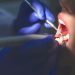 Justiça proíbe dentista de realizar cirurgias plásticas após pacientes sofrerem lesões estéticas em RO
