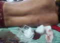 Tentativa de homicídio a facadas agita a madrugada deste sábado
