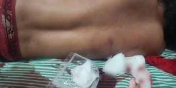 Tentativa de homicídio a facadas agita a madrugada deste sábado