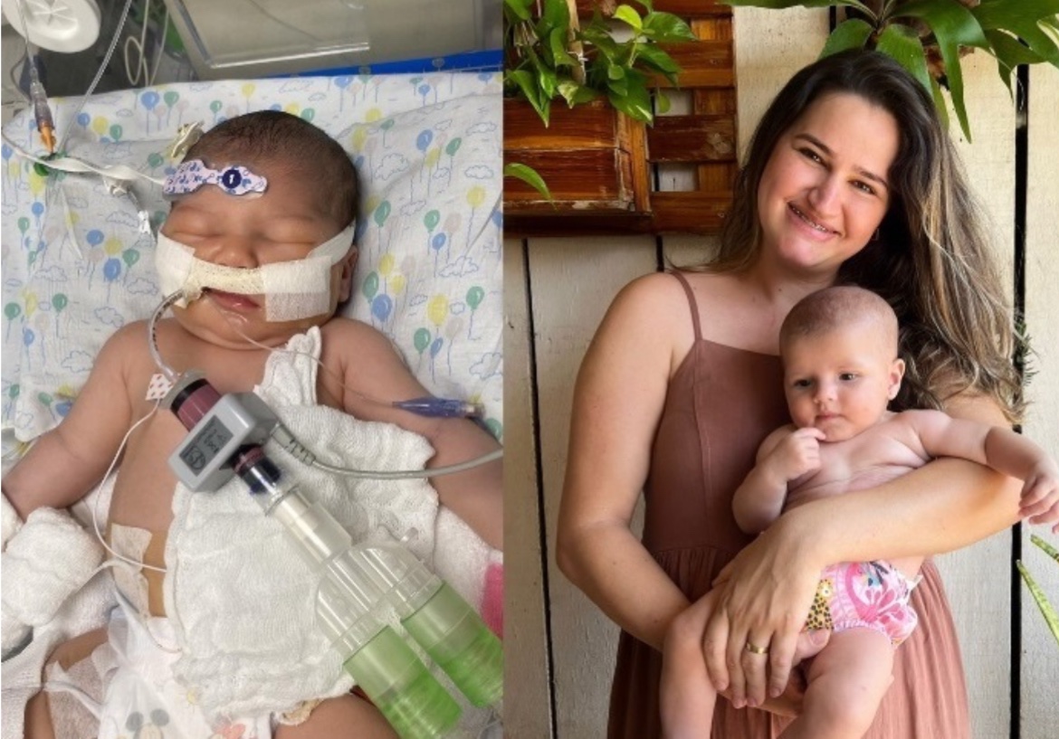 A história de superação de uma bebê com cardiopatia congênita; Rebeca ...