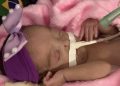 Polícia investiga morte de bebê prematura após pais denunciarem falta de materiais básicos em hospital de RO
