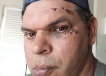 Jailton Delogo denuncia, calçadas continuam sendo um grande obstáculo para as pessoas com deficiência