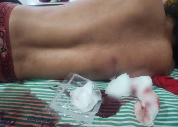 Tentativa de homicídio a facadas agita a madrugada deste sábado